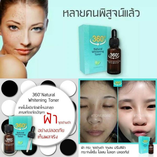 360 Natural Whitening Toner Serum - Toner for Melasma - Image 2