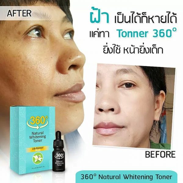 360 Natural Whitening Toner Serum - Toner for Melasma - Image 3