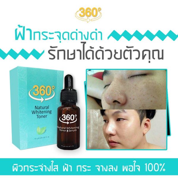 360 Natural Whitening Toner Serum - Toner for Melasma - Image 7