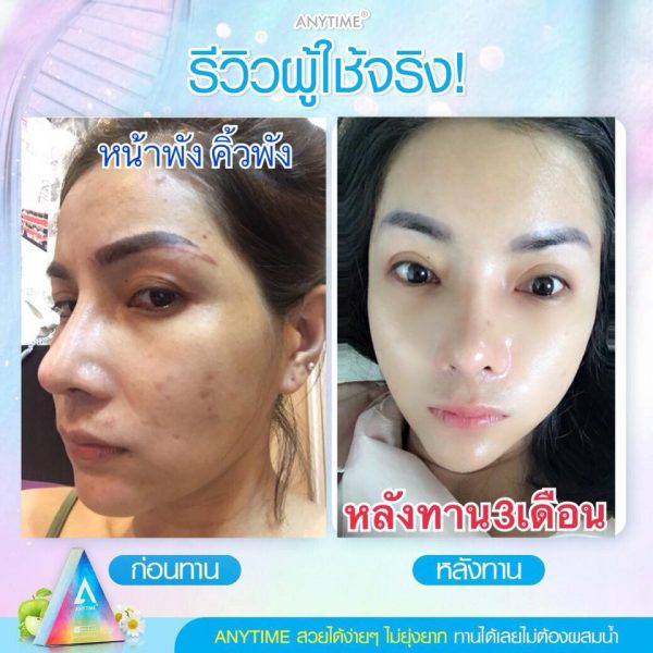 Anytime Stem Cell SC SOD & SOP - Skin Whitening Supplement - Image 11