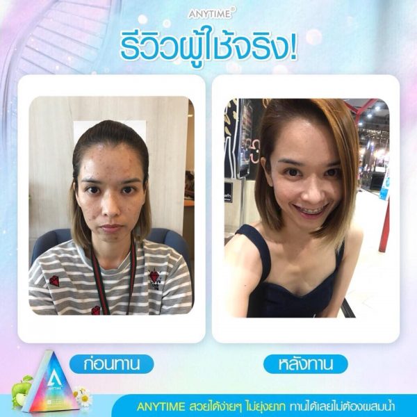 Anytime Stem Cell SC SOD & SOP - Skin Whitening Supplement - Image 12