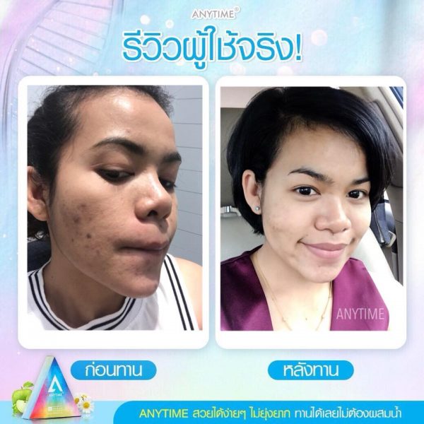 Anytime Stem Cell SC SOD & SOP - Skin Whitening Supplement - Image 13