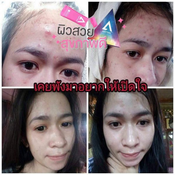 Anytime Stem Cell SC SOD & SOP - Skin Whitening Supplement - Image 14