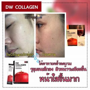 DW Collagen