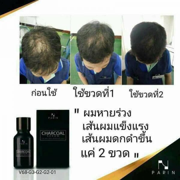 PARIN Charcoal Serum for Dry and Damaged Hair - Image 11