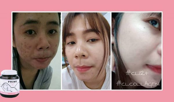 Prime CL Collagen - Image 10