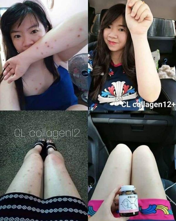 Prime CL Collagen - Image 12