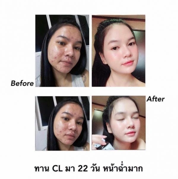 Prime CL Collagen