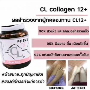 Prime CL Collagen