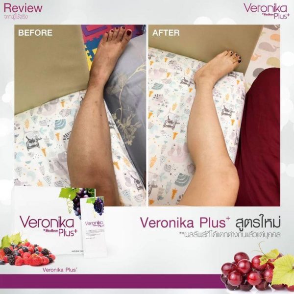 Veronika Plus by Medileen
