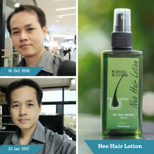 Neo Hair Lotion by Green Wealth