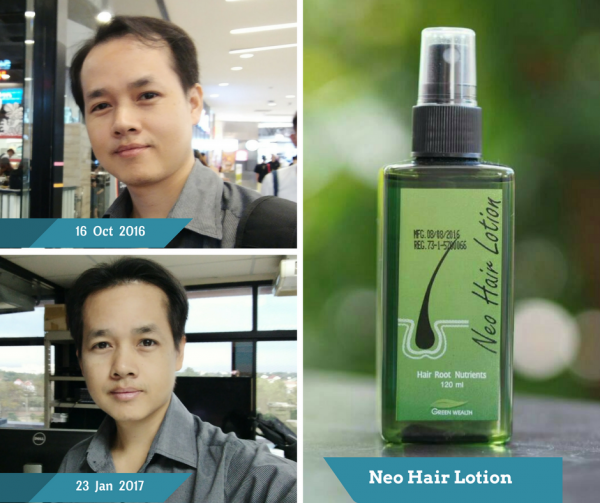 Neo Hair Lotion by Green Wealth