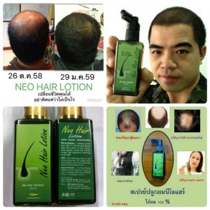 Neo Hair Lotion by Green Wealth