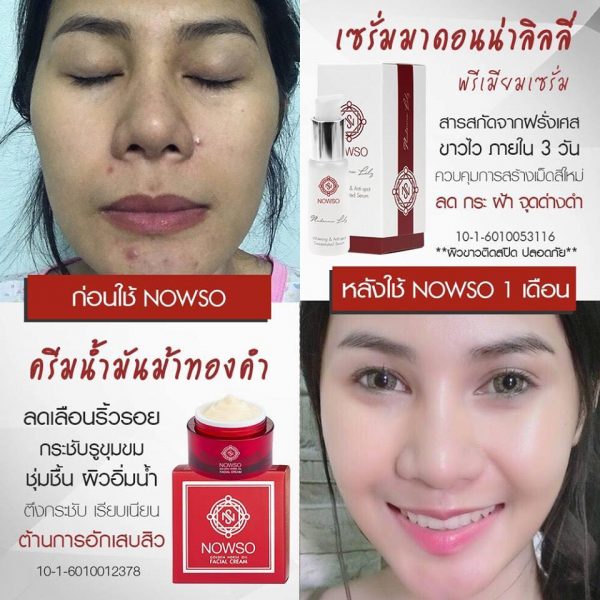 Nowso Madonna Lily Serum - Image 11