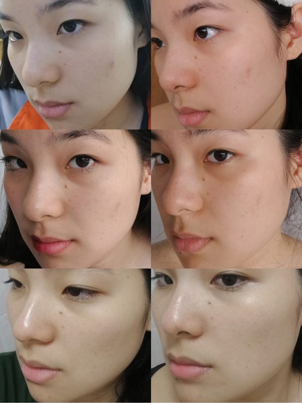 Nowso Madonna Lily Serum - Image 13