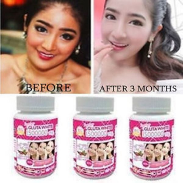 Supreme Gluta White 1500000 mg. - Image 10