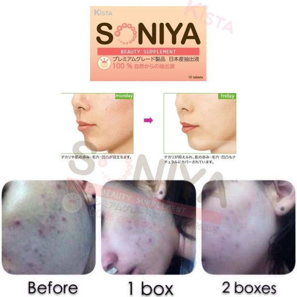 Soniya - Image 8