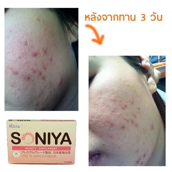 Soniya - Image 11