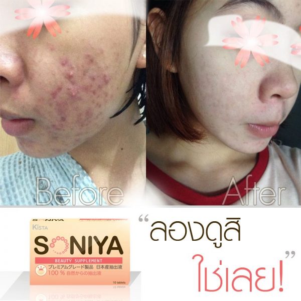 Soniya - Image 12
