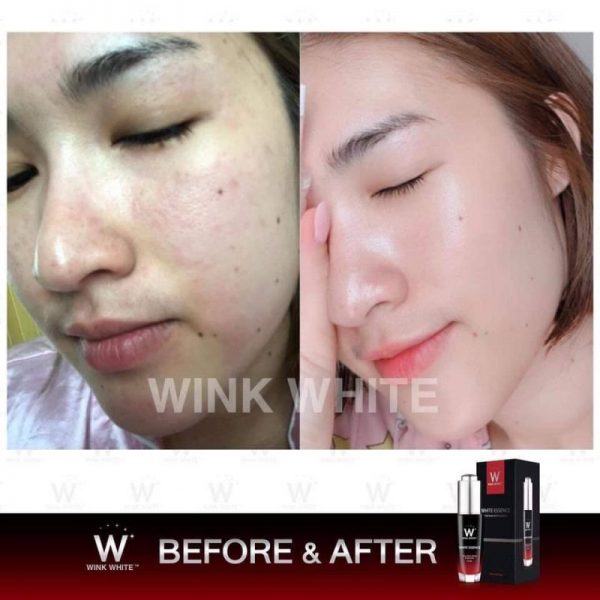 White Essence by Wink White - Image 14