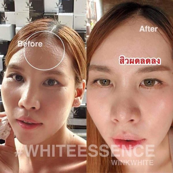 White Essence by Wink White - Image 12